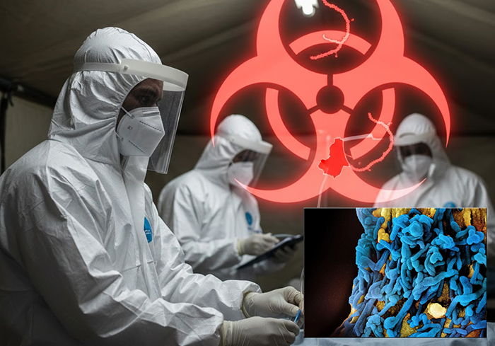 Ethiopia’s First Marburg Virus Outbreak: A Comprehensive Overview of the Crisis and Response